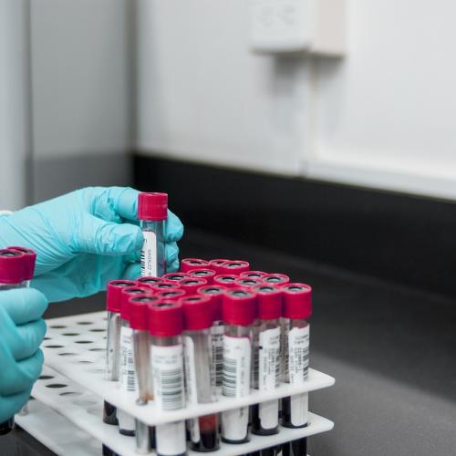 Biomarkers