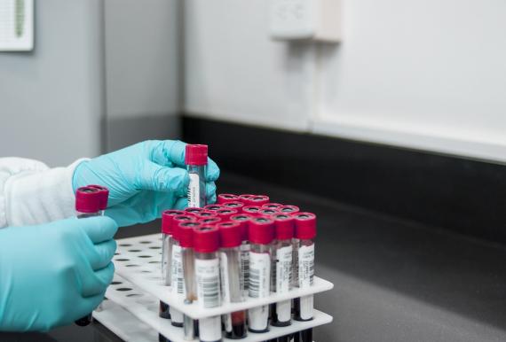 Biomarkers