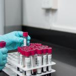 Biomarkers